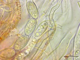 Sarcoscypha austriaca image