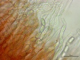 Sarcoscypha austriaca image