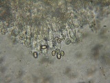 Inocybe amblyospora image