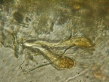 Aleurodiscus grantii image
