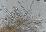 Sclerotinia sclerotiorum image