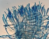 Sclerotinia sclerotiorum image