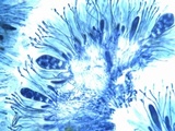 Caloplaca aurantia image