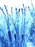 Caloplaca aurantia image