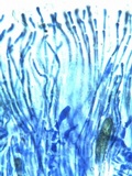 Caloplaca aurantia image