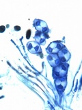 Caloplaca aurantia image