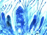 Caloplaca aurantia image
