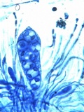 Caloplaca aurantia image