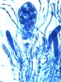 Caloplaca aurantia image