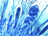 Caloplaca aurantia image