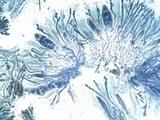 Caloplaca aurantia image
