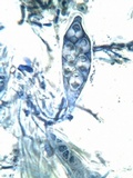 Caloplaca aurantia image