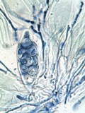 Caloplaca aurantia image