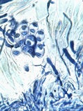 Caloplaca aurantia image