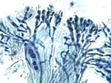 Caloplaca aurantia image