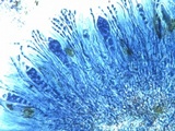 Caloplaca flavescens image