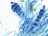Caloplaca flavescens image
