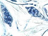 Caloplaca flavescens image