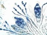Caloplaca flavescens image