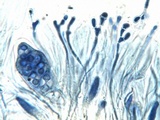 Caloplaca flavescens image