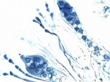 Caloplaca flavescens image
