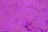 Beauveria brongniartii image