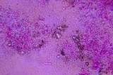 Beauveria brongniartii image