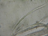 Hypomyces aurantius image