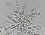 Incrucipulum ciliare image