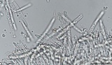Incrucipulum ciliare image