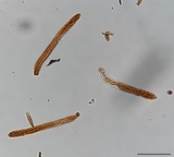 Incrucipulum ciliare image