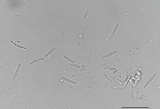 Incrucipulum ciliare image