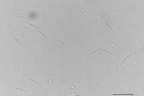 Incrucipulum ciliare image