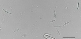 Incrucipulum ciliare image