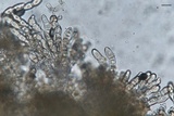 Puccinia horiana image
