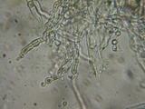 Aleurodiscus grantii image