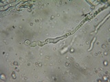 Aleurodiscus grantii image