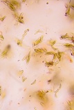 Eutypella leprosa image