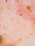 Eutypella leprosa image