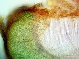 Leptogium biatorinum image