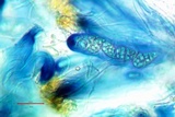 Scytinium biatorinum image