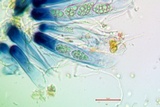 Scytinium biatorinum image