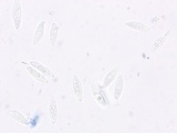 Lepiota spheniscispora image