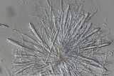 Lophodermium melaleucum image