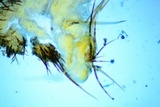 Scutellinia setosa image