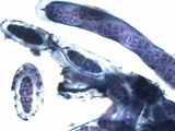 Hysterobrevium smilacis image