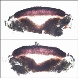 Tephromela atra var. atra image