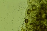 Taphrina deformans image