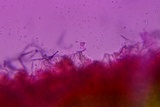 Taphrina deformans image
