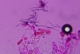 Taphrina deformans image